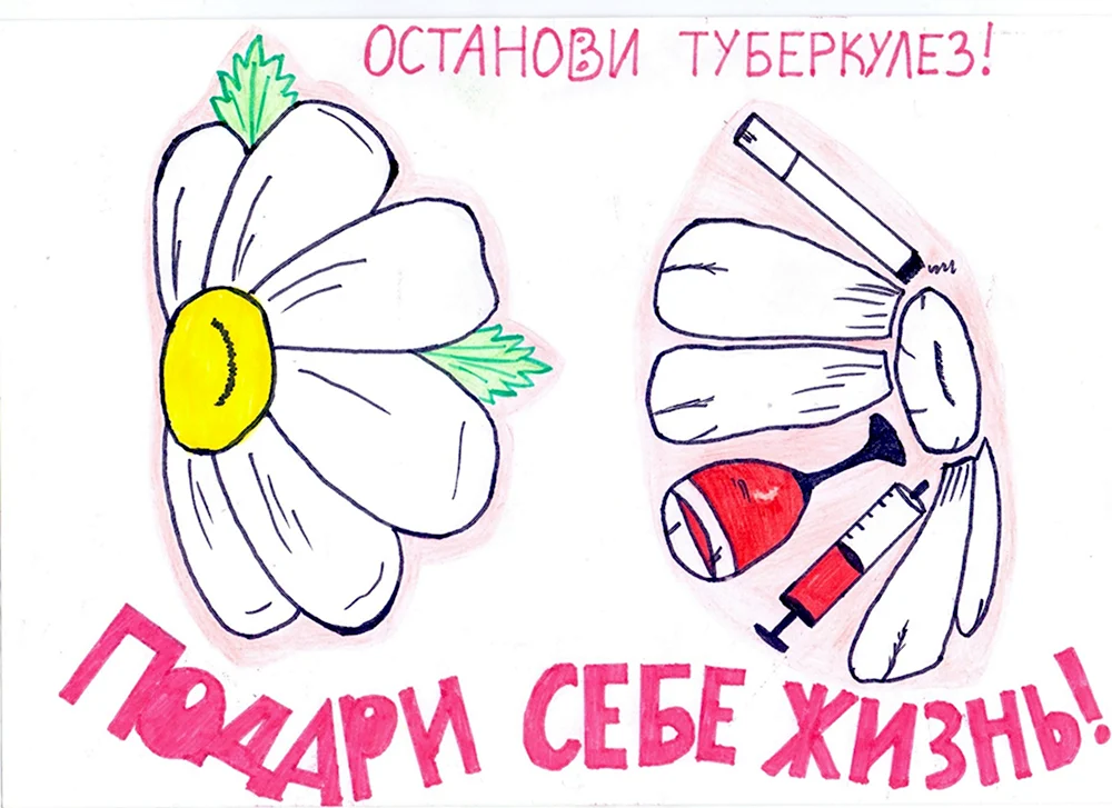 Туберкулез рисунок