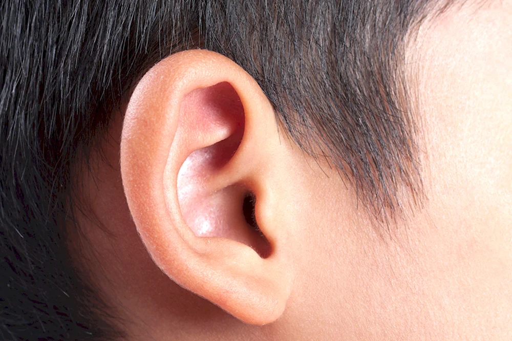 Абсцесс тканей наружного уха
