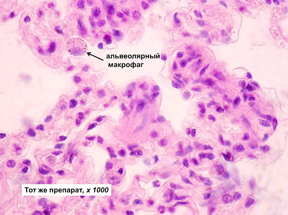 Альвеолярные макрофаги гистология