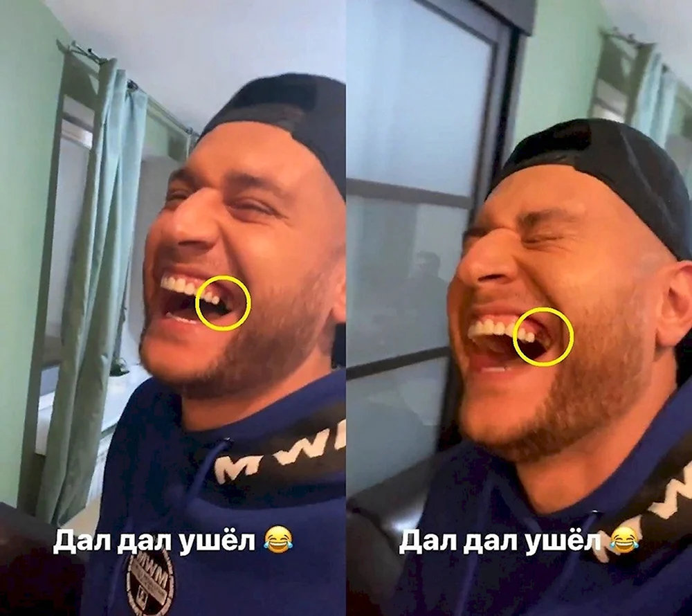 Давид Манукян зубы