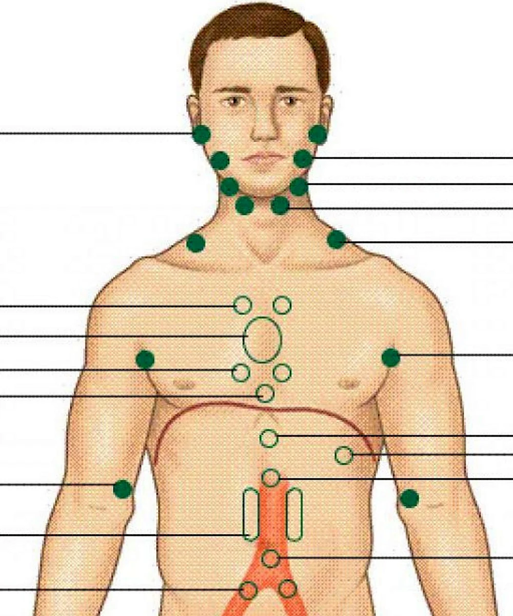 Лимфоузлы у мужчин расположение картинки