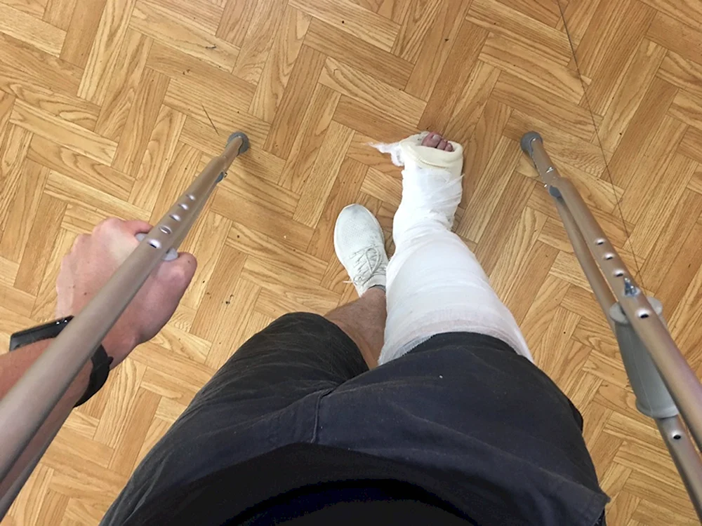 Константин Коновалов сломали ногу