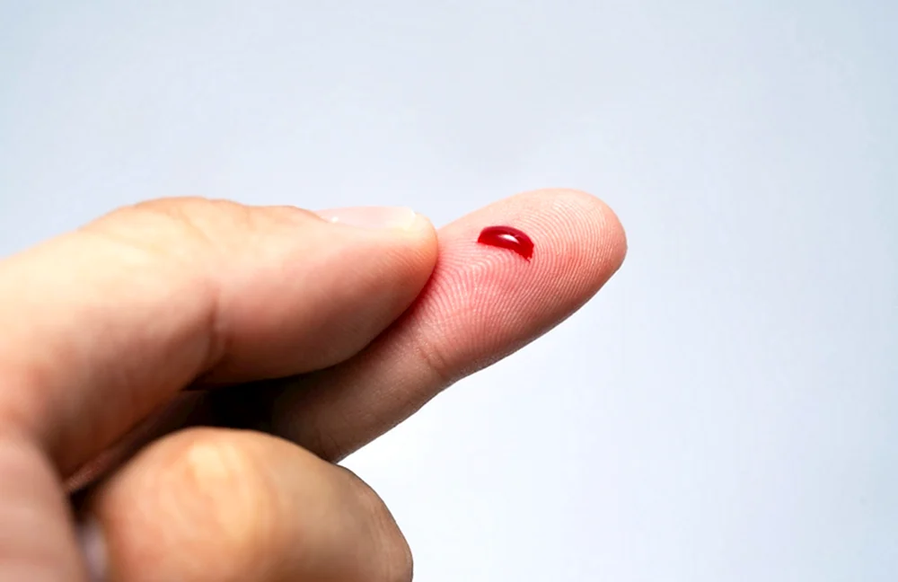 Кровоточащая рана на пальце