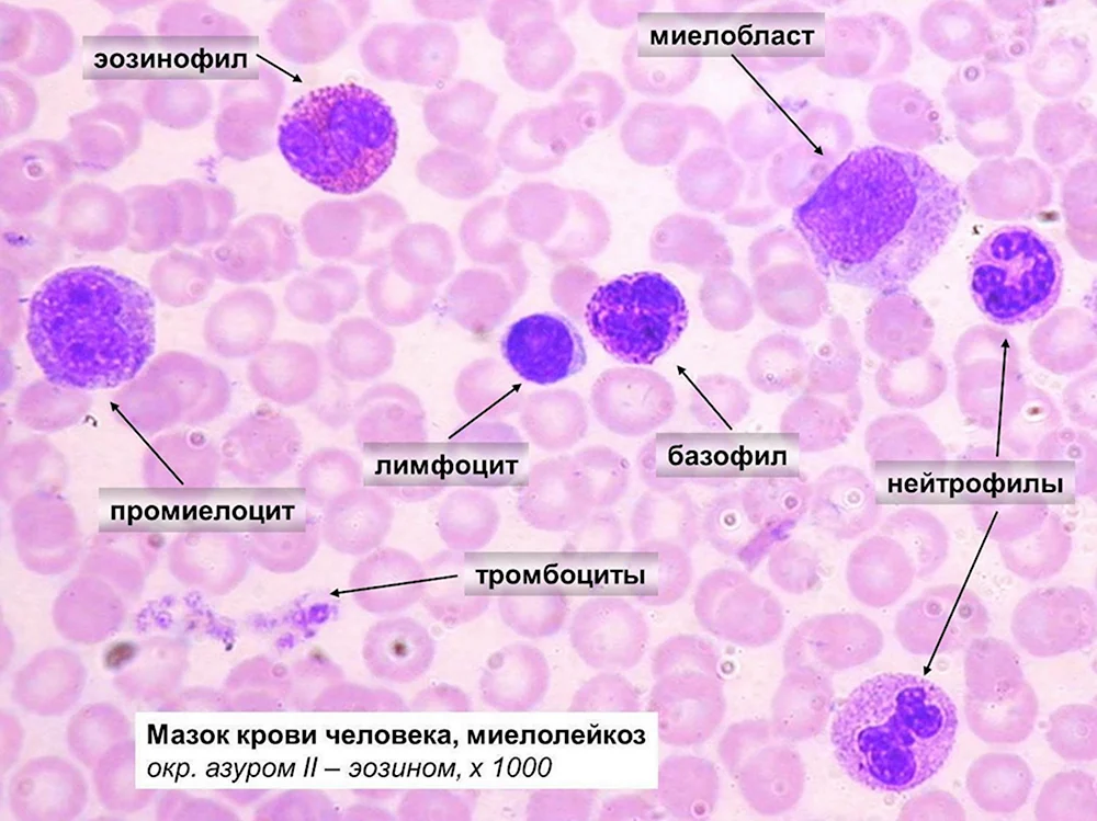 Мазок крови человека лейкоциты препарат