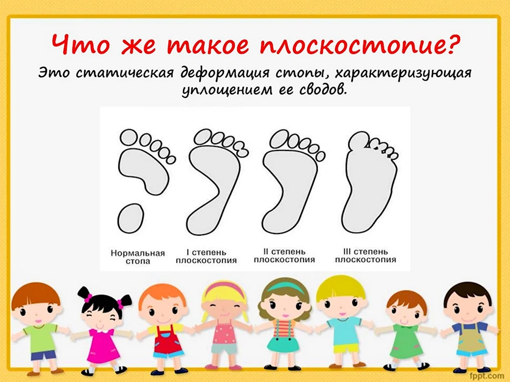 Методика профилактики плоскостопия у дошкольников