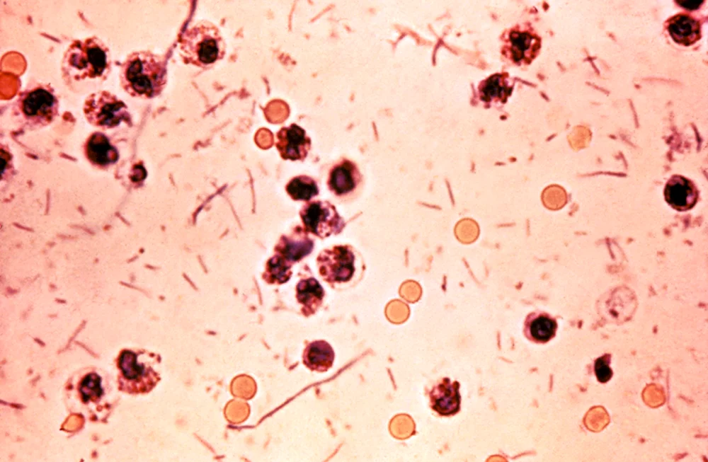 Микроскопия кала лейкоциты