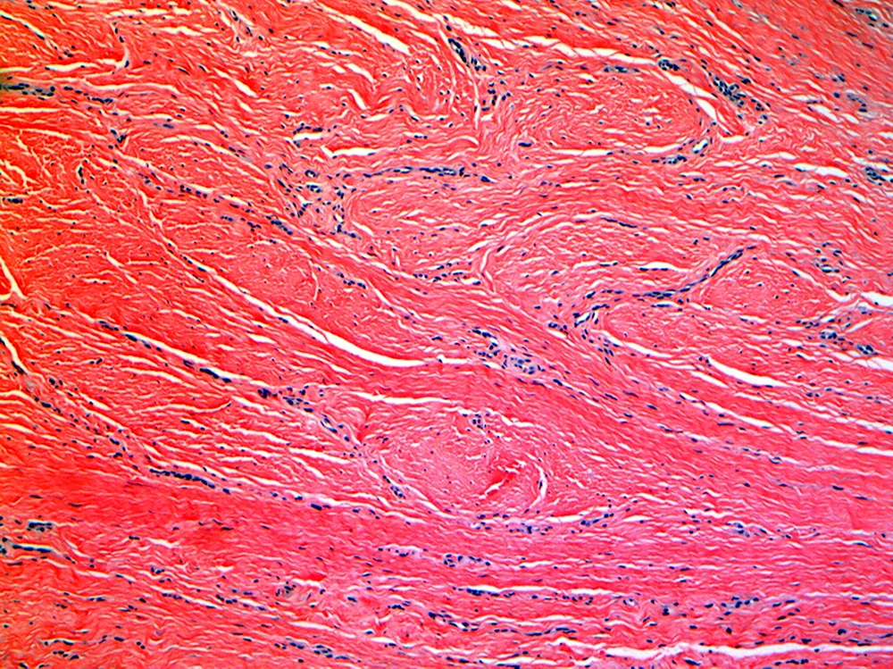 Мышечная клетка гистология