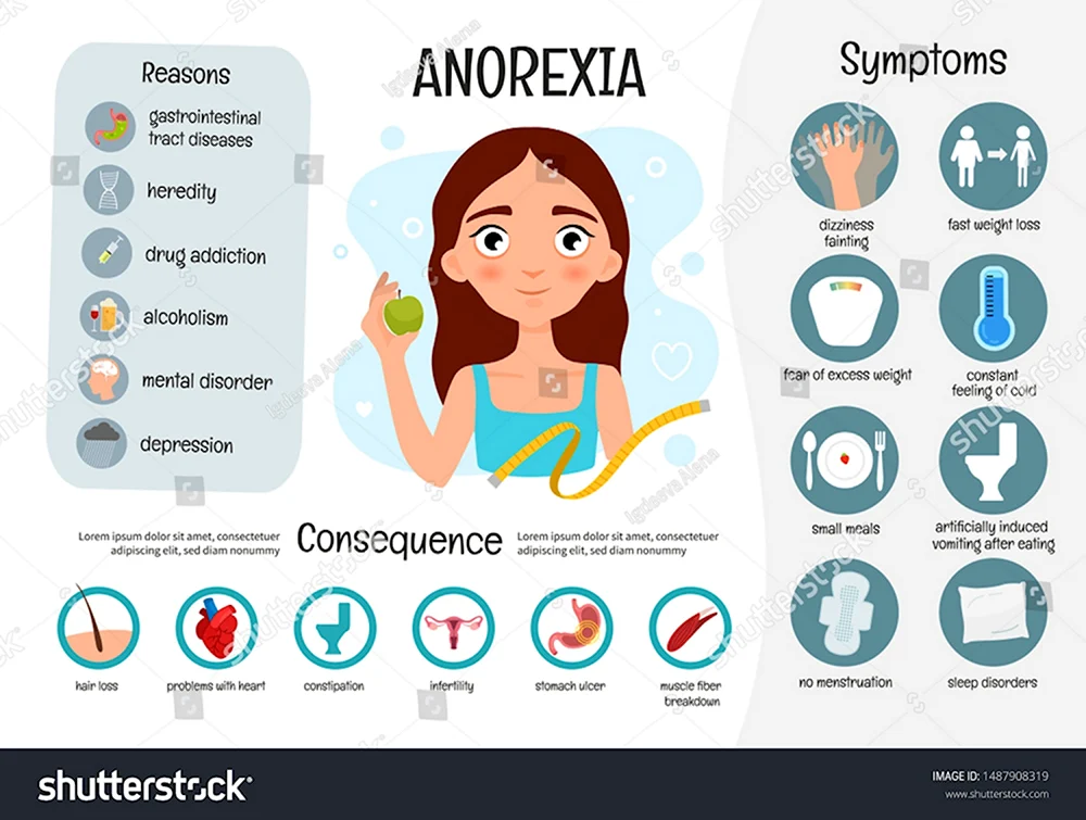 Нейрогенная анорексия