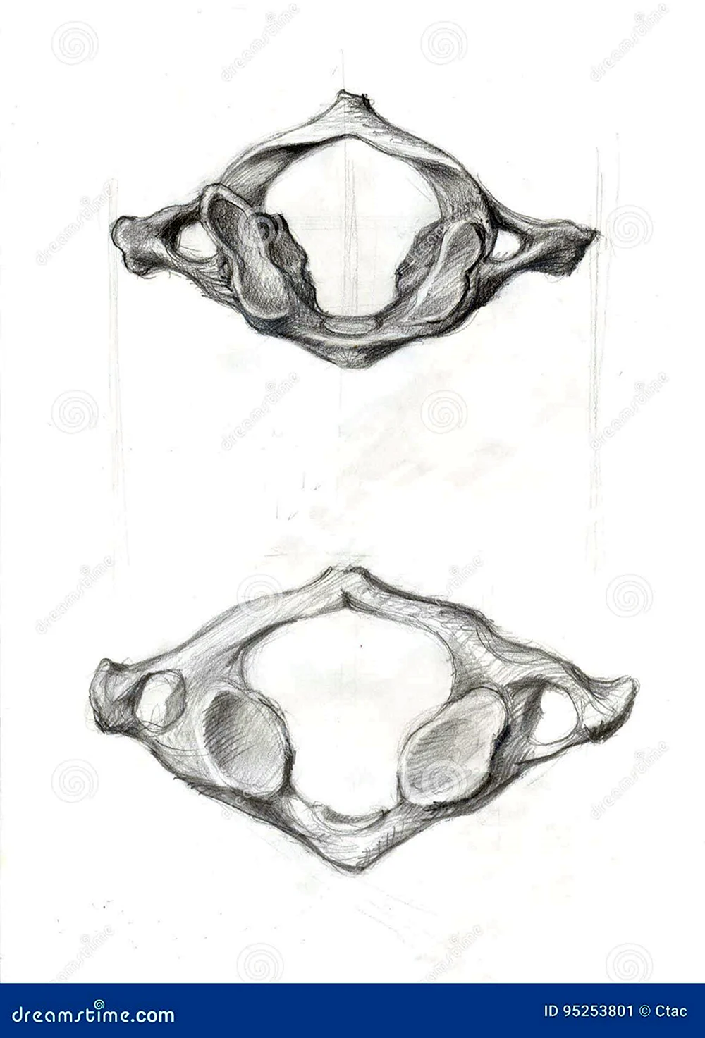 Первый шейный позвонок Атлант вид сверху