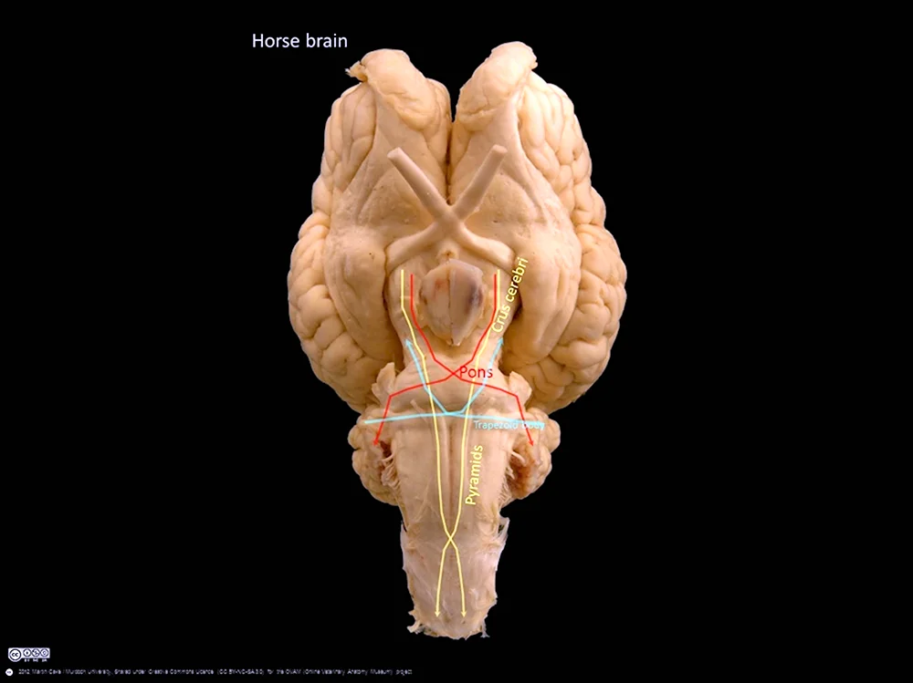 Продолговатый мозг анатомия препарат