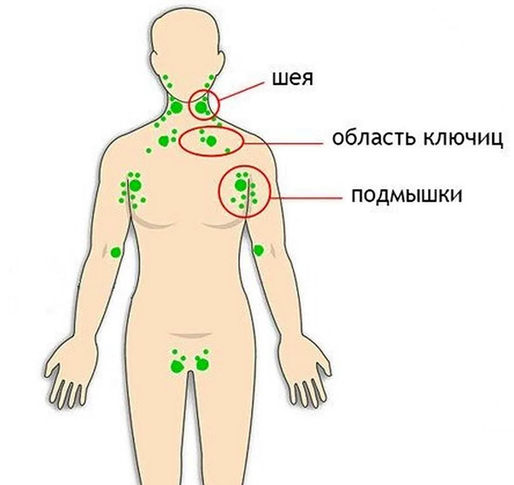 Расположение групп лимфатических узлов тела человека