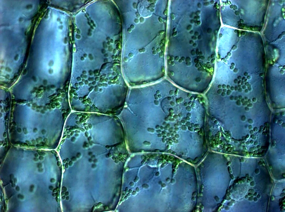 Растительная клетка листа элодеи