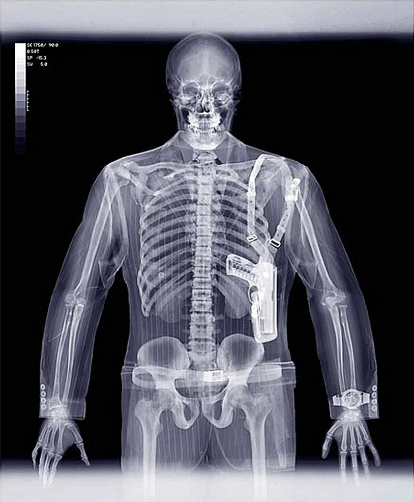 Рентгеновского излучения x- ray