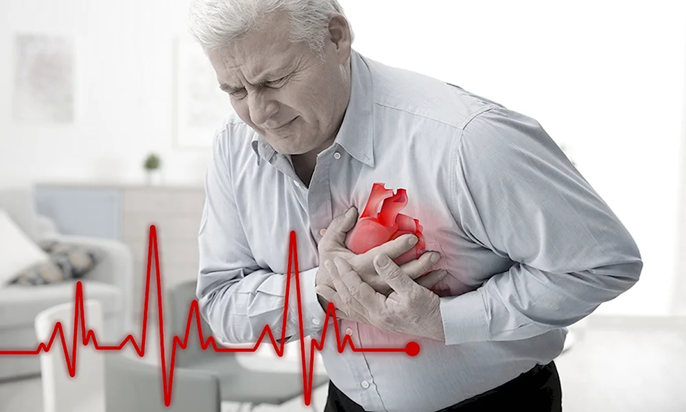 Сердечный приступ инфаркт миокарда