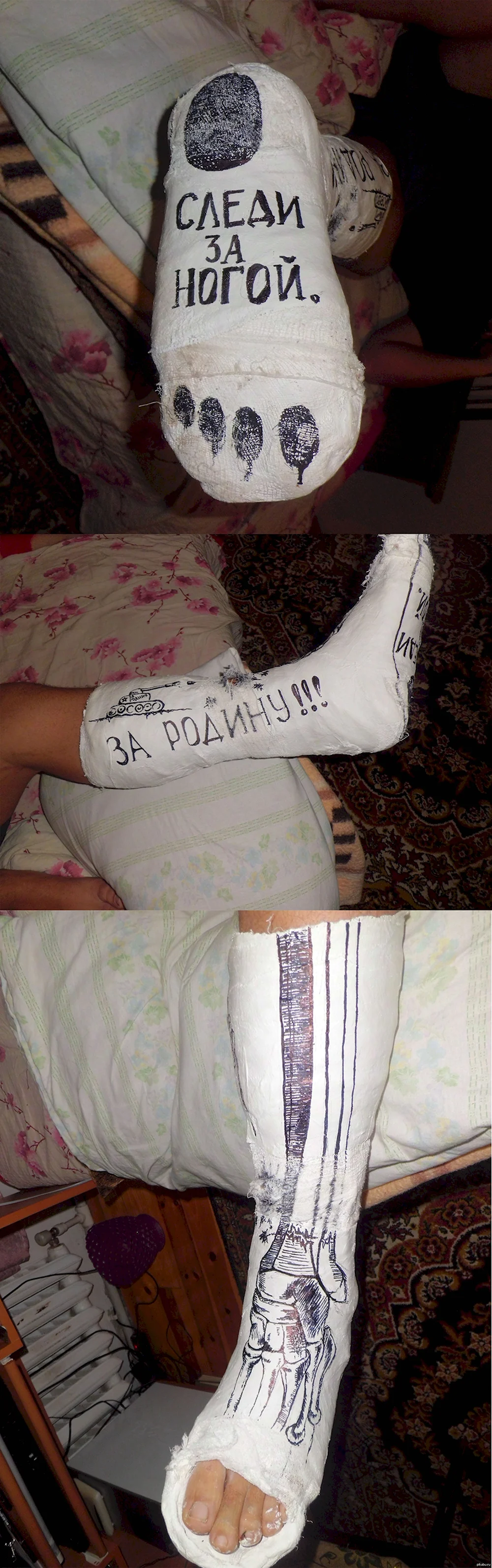 Смешные надписи на гипсе