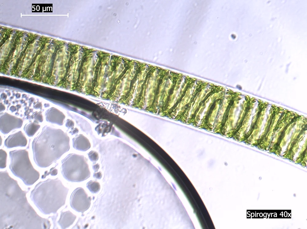 Спирогира в микроскопе