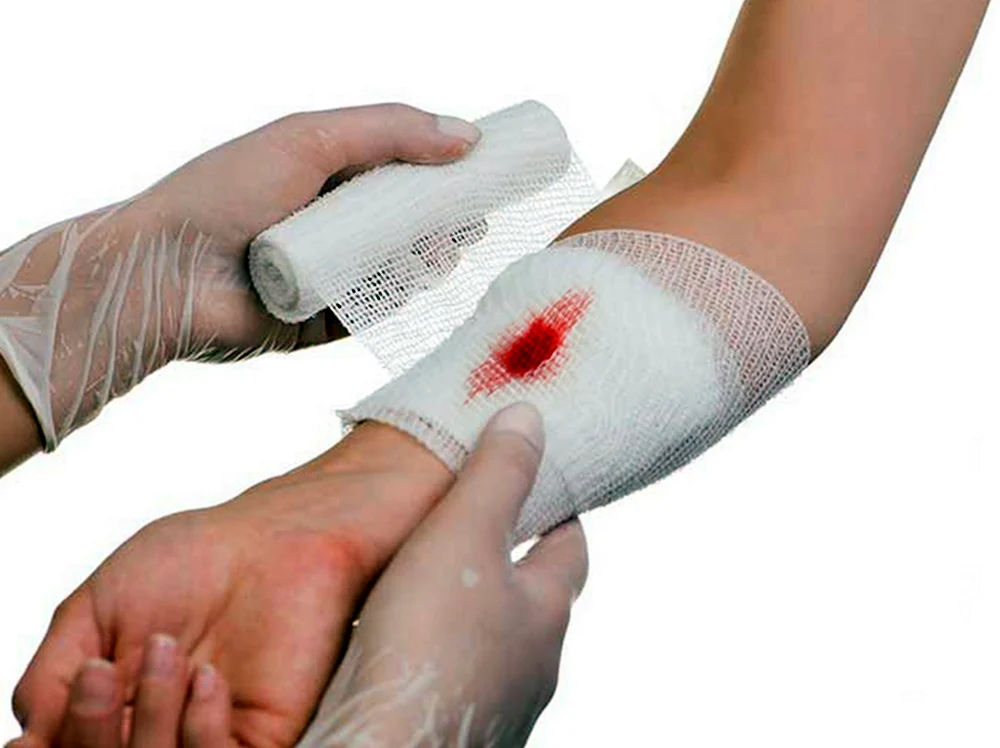 Стерильная повязка на рану