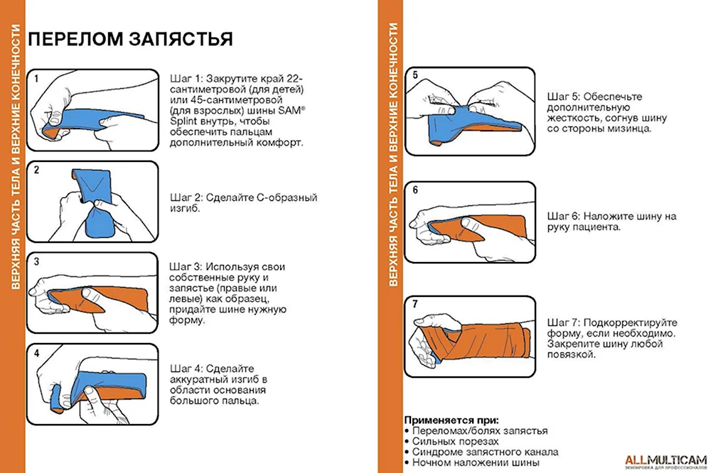 Ультралегкая иммобилизационная формовочная шина Sam Splint II