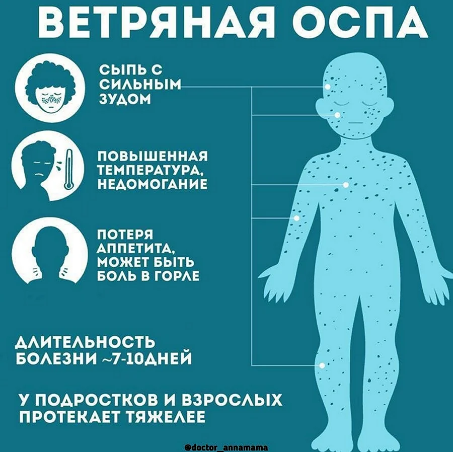 Вирусная инфекция ветрянка