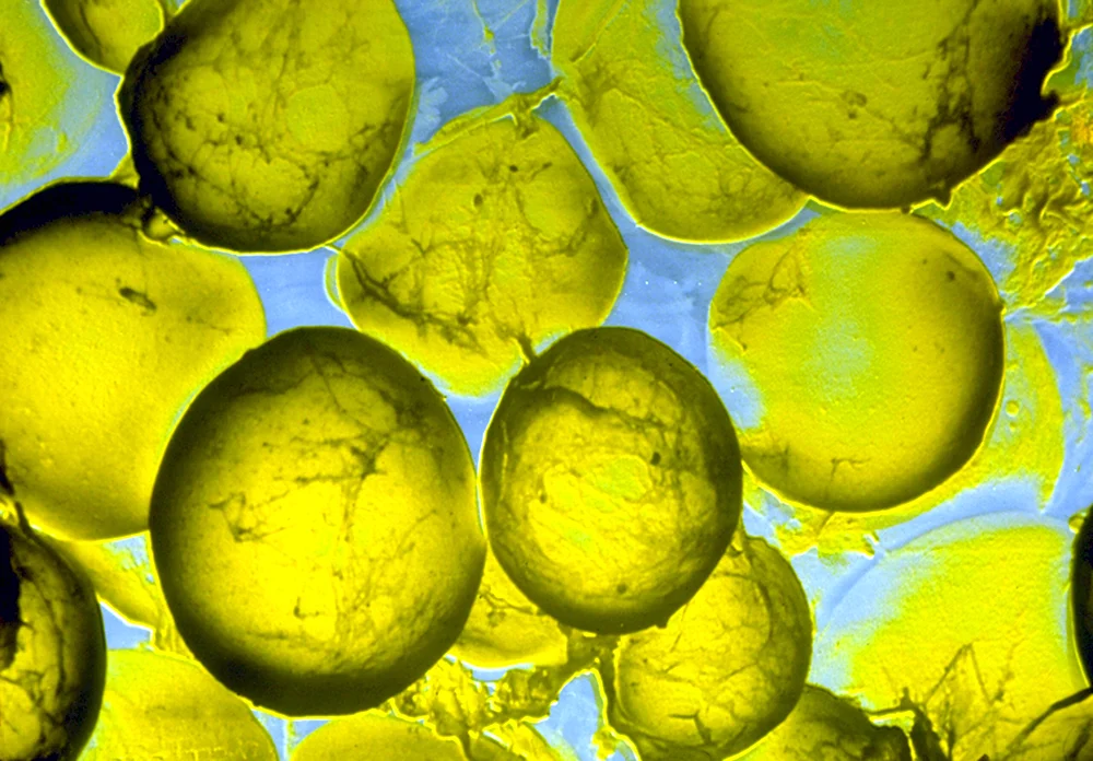Жировые клетки под микроскопом