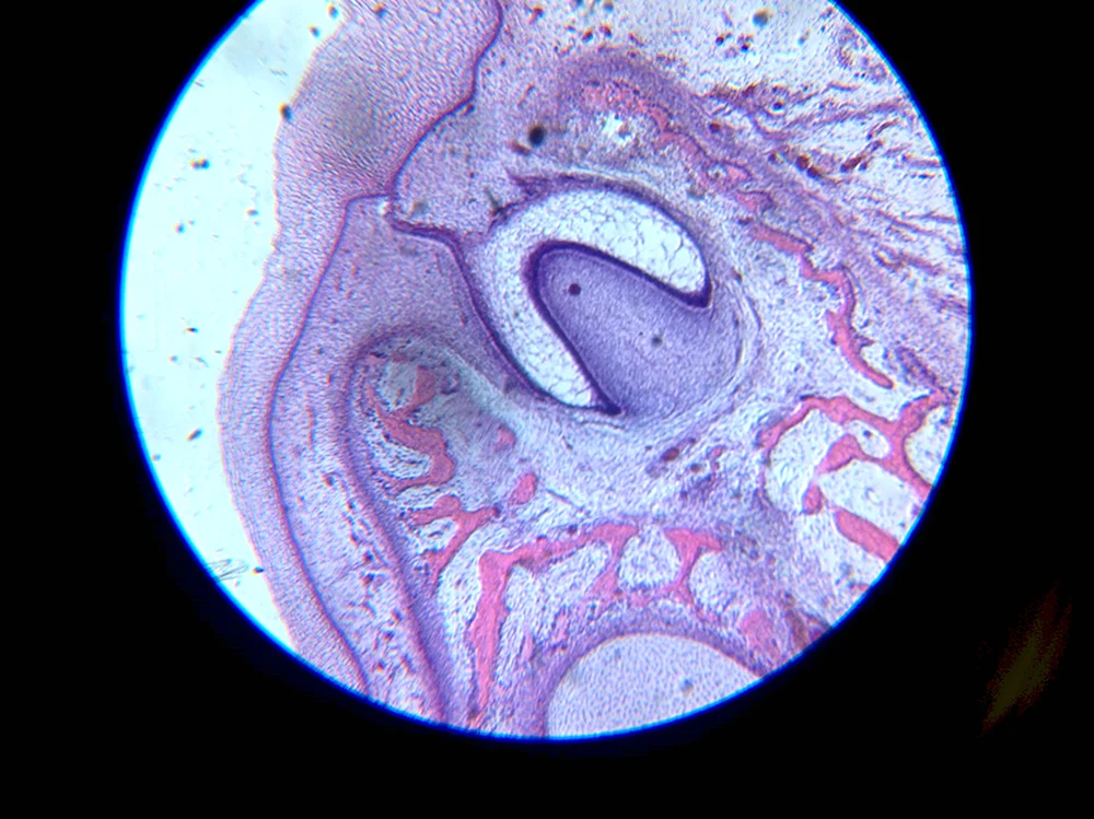 Зубной мешочек гистология